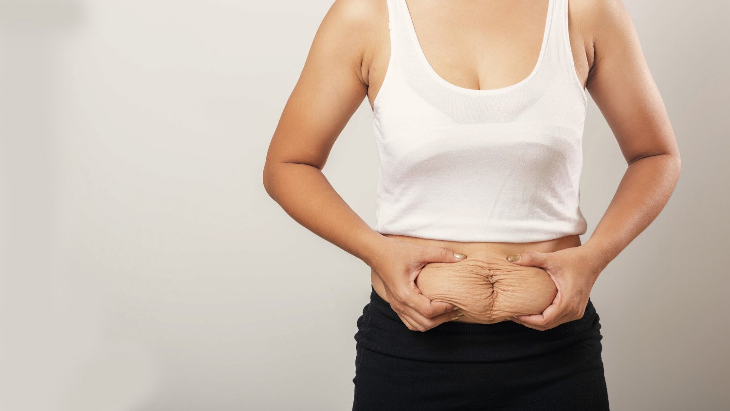 KARIN GERME (ABDOMİNOPLASTİ)